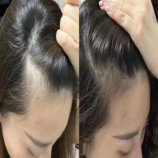 Real Results: Clinical Outcomes After Exosome Therapy for Hair &amp; Skin Rejuvenation